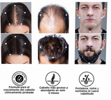 Sérum en Roll-on para el crecimiento del cabello de Bodywise